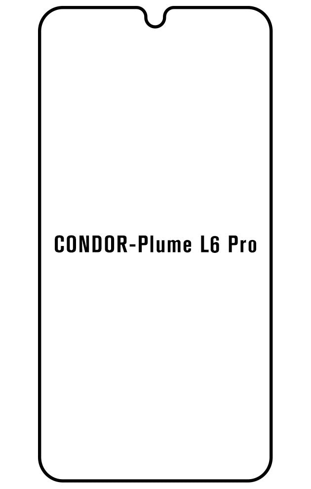 Film hydrogel Condor Plume L6 Pro - Film écran anti-casse Hydrogel