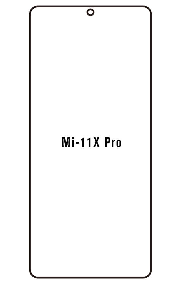 Film hydrogel Xiaomi Mi 11X Pro - Film écran anti-casse Hydrogel