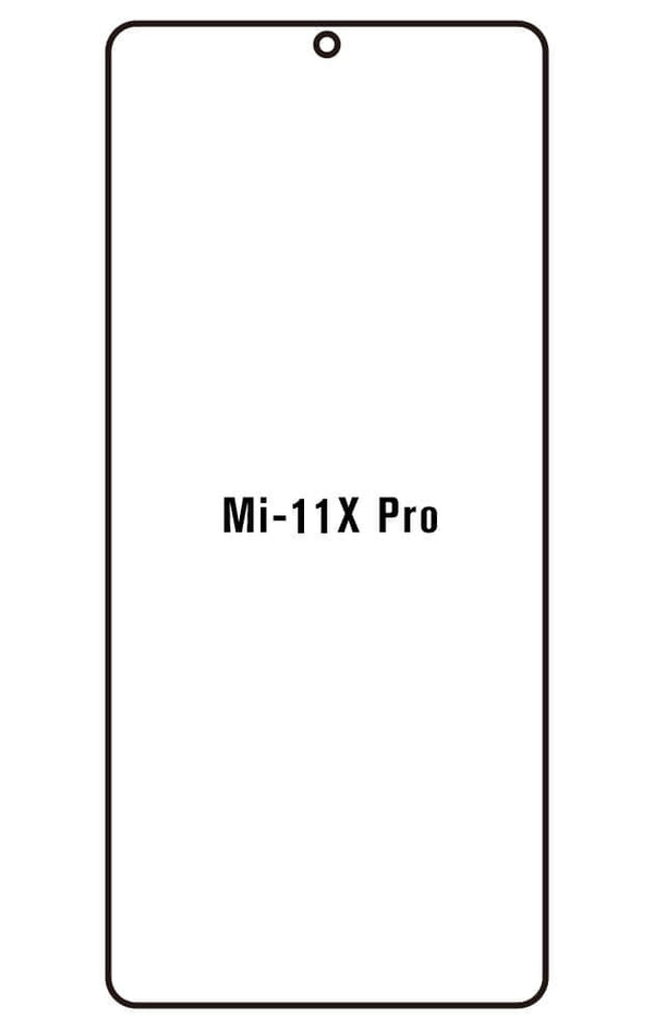 Film hydrogel Xiaomi Mi 11X Pro - Film écran anti-casse Hydrogel