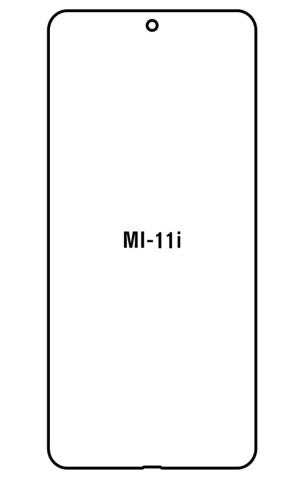 Film hydrogel Xiaomi Mi 11i - Film écran anti-casse Hydrogel