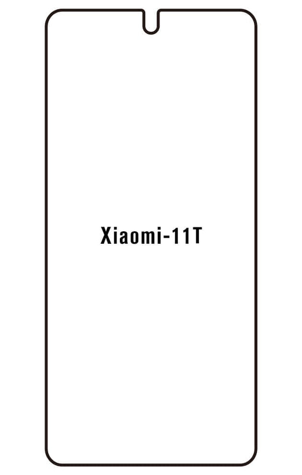 Film hydrogel Xiaomi Mi 11T - Film écran anti-casse Hydrogel