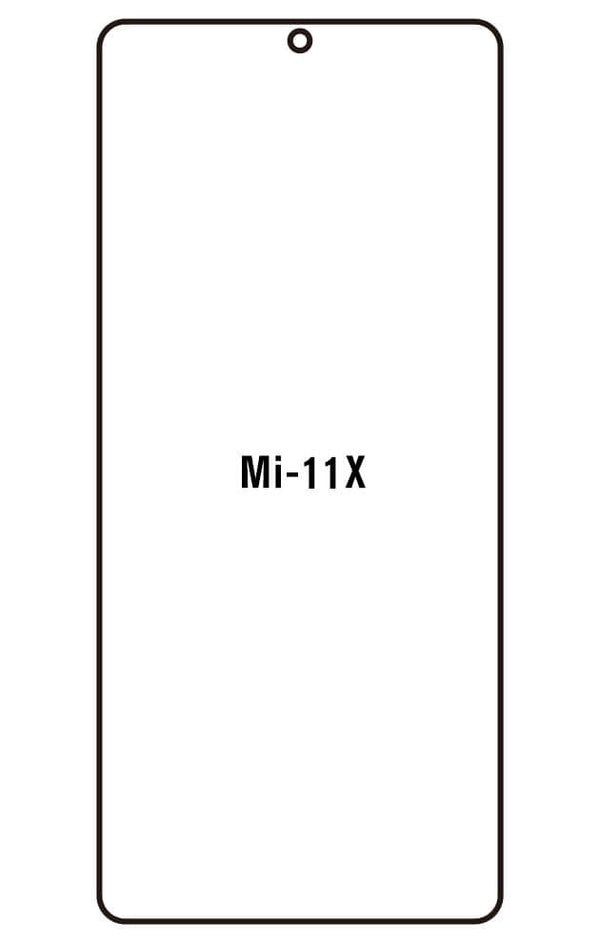 Film hydrogel Xiaomi Mi 11X - Film écran anti-casse Hydrogel
