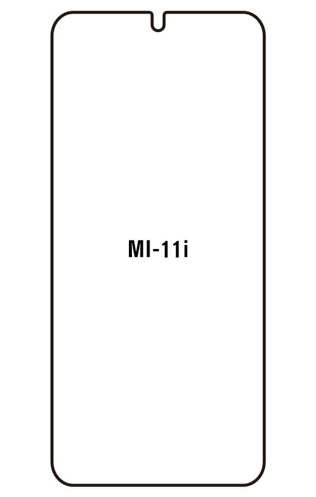 Film hydrogel pour Xiaomi Mi Mi 11i - Mi 11i HyperCharge (2022)
