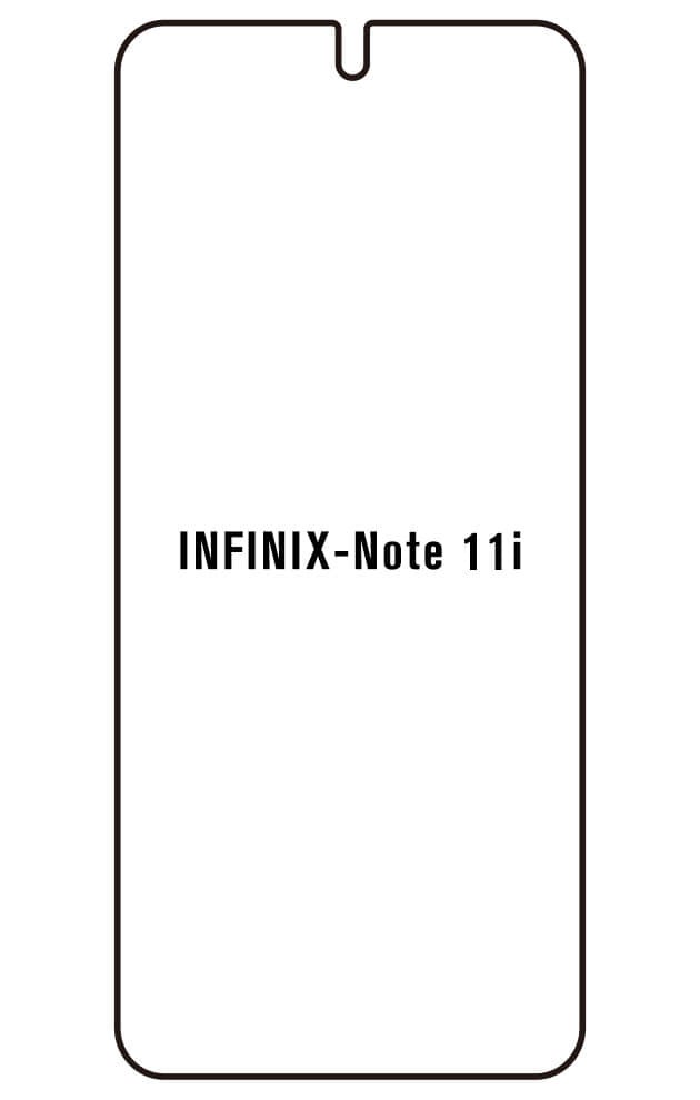 Film hydrogel pour écran Infinix Note 11i