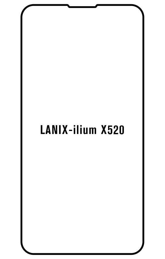 Film hydrogel Lanix Ilium X520 - Film écran anti-casse Hydrogel