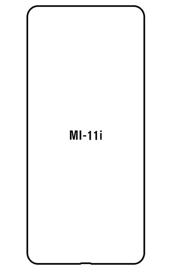 Film hydrogel pour écran Xiaomi Mi Mi 11i  (2021)